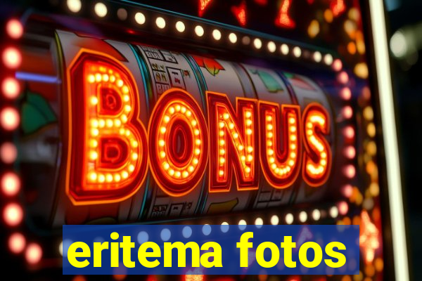 eritema fotos